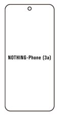 engaroGuard Hidrogél - védőfólia - Nothing Phone (3a)