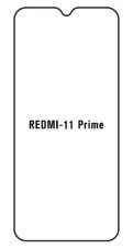 engaroGuard Hydrogel - ochranná fólie - Xiaomi Redmi 11 Prime 5G