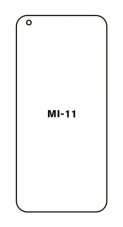 Hydrogel - ochranná fólia - Xiaomi Mi 11 Hydrogel - ochranná fólia - Xiaomi Mi 11