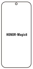 engaroGuard Hidrogél - védőfólia - Honor Magic 8