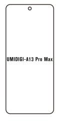engaroGuard Hydrogel - ochranná fólia - Umidigi A13 Pro Max 5G