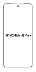 engaroGuard Hydrogel - ochranná fólia - Infinix Note 40 Pro+