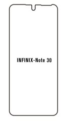 engaroGuard Hydrogel - ochranná fólia - Infinix Note 30