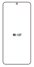 Hidrogél - védőfólia - Xiaomi 12T