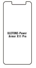 engaroGuard Hydrogel - ochranná fólie - Ulefone Power Armor X11 Pro