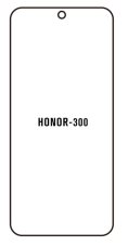 engaroGuard Hydrogel - ochranná fólia - Honor 300 5G