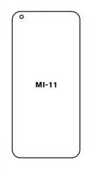 Hydrogel - ochranná fólia - Xiaomi Mi 11 Hydrogel - ochranná fólia - Xiaomi Mi 11