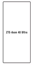 Hydrogel - ochranná fólia - ZTE Axon 40 Ultra Hydrogel - ochranná fólia - ZTE Axon 40 Ultra