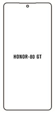 engaroGuard Hydrogel - ochranná fólie - Huawei Honor 80 GT