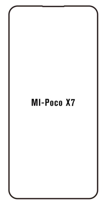 engaroGuard Hydrogel - ochranná fólia - Xiaomi Poco X7 5G