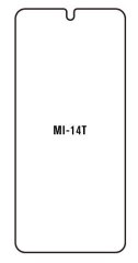 engaroGuard Hydrogel - ochranná fólia - Xiaomi 14T