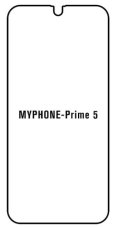 engaroGuard Hydrogel - ochranná fólie - MyPhone Prime 5