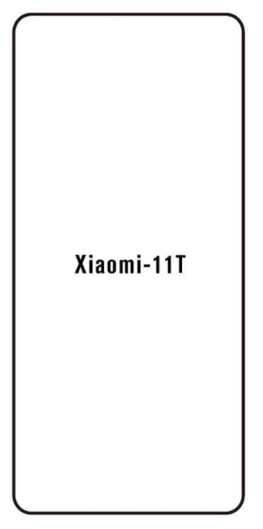 Hydrogel - ochranná fólia - Xiaomi 11T