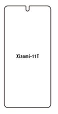 Hydrogel - ochranná fólia - Xiaomi 11T