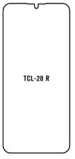 engaroGuard Hydrogel - ochranná fólie - TCL 20 R 5G