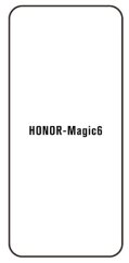 Hydrogel - ochranná fólia - Huawei Honor Magic6