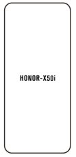 engaroGuard Hydrogel - ochranná fólie - Huawei Honor X50i