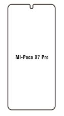 engaroGuard Hidrogél - védőfólia - Xiaomi Poco X7 Pro 5G
