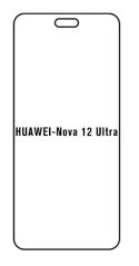 engaroGuard Hydrogel - ochranná fólia - Huawei Nova 12 Ultra