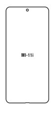 Hydrogel - ochranná fólia - Xiaomi Mi 11i