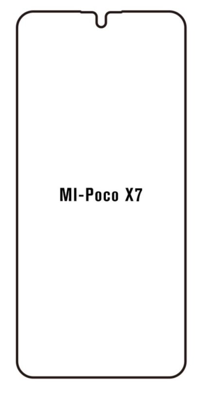 engaroGuard Hydrogel - ochranná fólia - Xiaomi Poco X7 5G