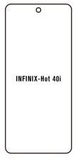 engaroGuard Hidrogél - védőfólia - Infinix Hot 40i