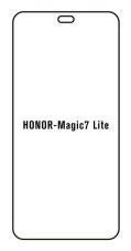 engaroGuard Hidrogél - védőfólia - Honor Magic 7 lite