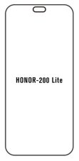 engaroGuard Hidrogél - védőfólia - Honor 200 lite
