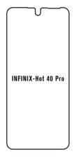 engaroGuard Hidrogél - védőfólia - Infinix Hot 40 Pro