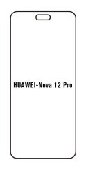 engaroGuard Hydrogel - ochranná fólia - Huawei Nova 12 Pro