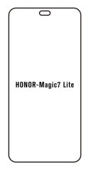 engaroGuard Hydrogel - ochranná fólia - Huawei Honor Magic 7 lite