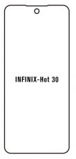 Hidrogél - védőfólia - Infinix Hot 30