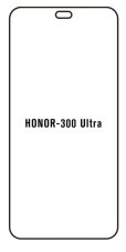 engaroGuard Hydrogel - ochranná fólia - Honor 300 Ultra