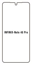engaroGuard Hidrogél - védőfólia - Infinix Note 40 Pro