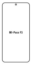 Hidrogél - védőfólia - Xiaomi Poco F3 Hidrogél - védőfólia - Xiaomi Poco F3