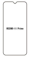 Hydrogel - ochranná fólia - Xiaomi Redmi 11 Prime 5G Hydrogel - ochranná fólia - Xiaomi Redmi 11 Prime 5G