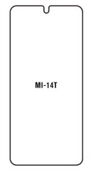 engaroGuard Hydrogel - ochranná fólia - Xiaomi 14T