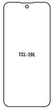 engaroGuard Hydrogel - ochranná fólie - TCL 20L