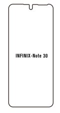 engaroGuard Hidrogél - védőfólia - Infinix Note 30