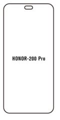 engaroGuard Hydrogel - ochranná fólia - Huawei Honor 200 Pro