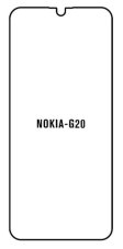 engaroGuard Hydrogel - ochranná fólie - Nokia G20