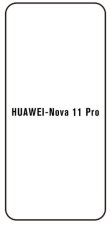 Hidrogél - védőfólia - Huawei Nova 11 Pro