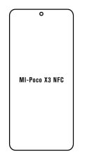 Hidrogél - védőfólia - Xiaomi Poco X3 NFC