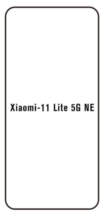 Hidrogél - védőfólia - Xiaomi 11 lite 5G NE