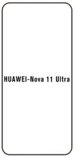 engaroGuard Hydrogel - ochranná fólie - Huawei Nova 11 Ultra