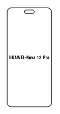 engaroGuard Hidrogél - védőfólia - Huawei Nova 12 Pro