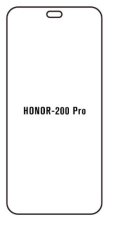engaroGuard Hidrogél - védőfólia - Honor 200 Pro