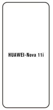 Hydrogel - ochranná fólia - Huawei Nova 11i