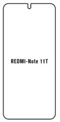 Hydrogel - ochranná fólia - Xiaomi Redmi Note 11T 5G