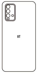 Hydrogel - zadná ochranná fólia - Xiaomi Redmi 9T Hydrogel - zadná ochranná fólia - Xiaomi Redmi 9T